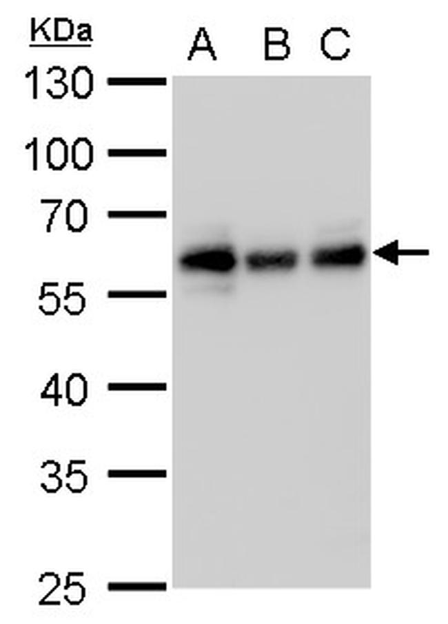 CALCOCO2 Antibody in Western Blot (WB)