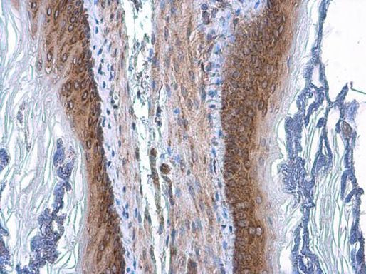 COPD Antibody in Immunohistochemistry (Paraffin) (IHC (P))