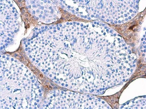 TPI1 Antibody in Immunohistochemistry (Paraffin) (IHC (P))