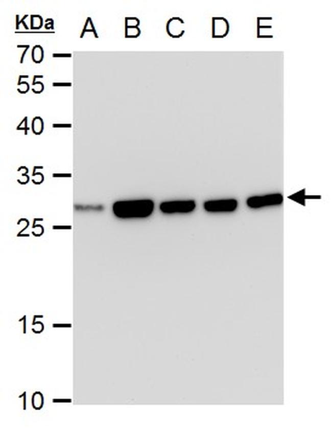 TPI1 Antibody in Western Blot (WB)