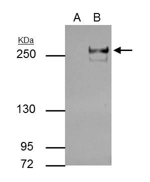 TET2 Antibody in Immunoprecipitation (IP)