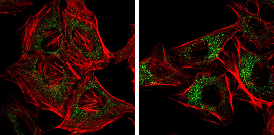 CALCOCO2 Antibody in Immunocytochemistry (ICC/IF)