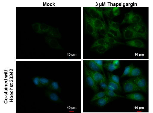 CALCOCO2 Antibody in Immunocytochemistry (ICC/IF)