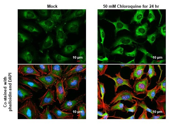 CALCOCO2 Antibody in Immunocytochemistry (ICC/IF)