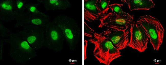 CAS Antibody in Immunocytochemistry (ICC/IF)