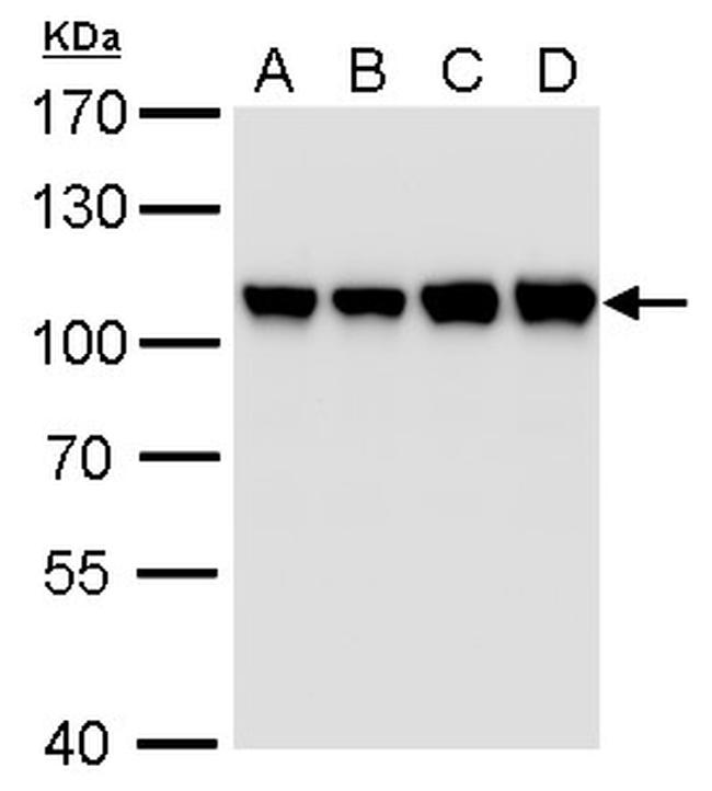 CAS Antibody in Western Blot (WB)