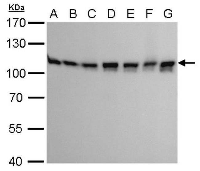 CAS Antibody in Western Blot (WB)