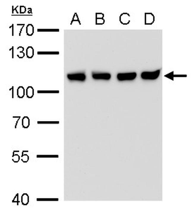 CAS Antibody in Western Blot (WB)