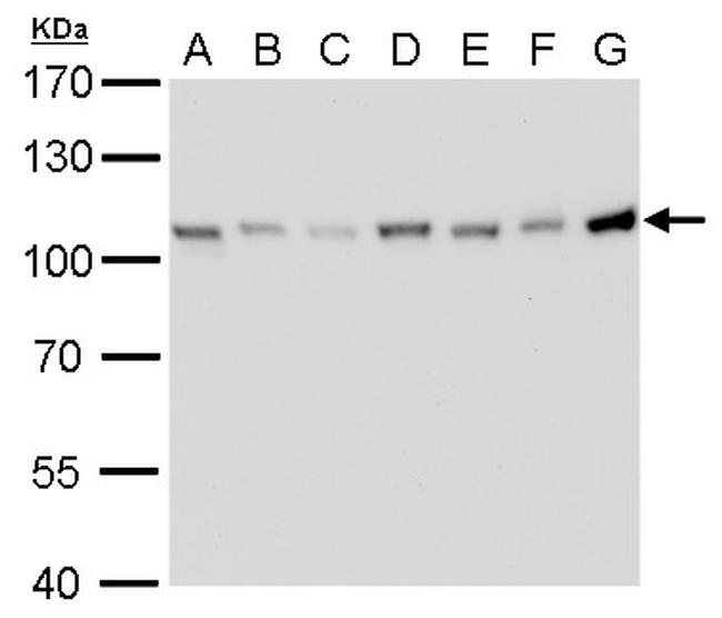 CAS Antibody in Western Blot (WB)