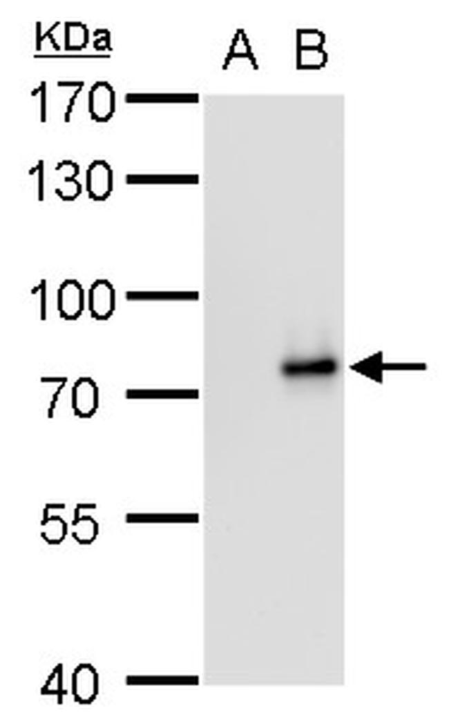 SLU7 Antibody in Western Blot (WB)