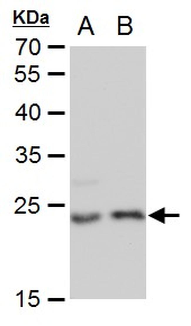 LIN7A Antibody in Western Blot (WB)