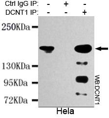 Dynactin 1 Antibody in Immunoprecipitation (IP)