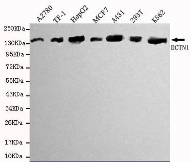 Dynactin 1 Antibody in Western Blot (WB)