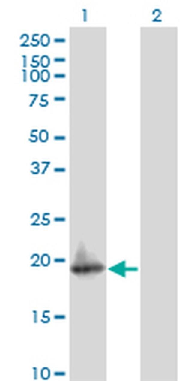 ARF5 Antibody in Western Blot (WB)