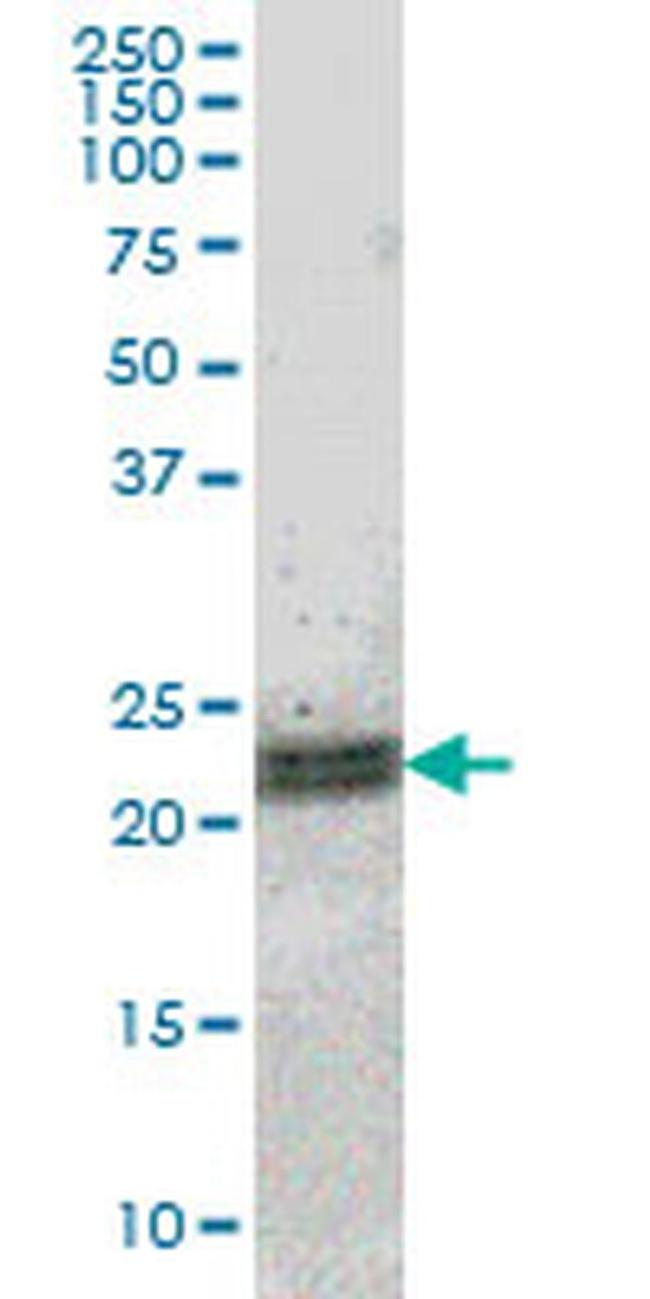 ATF3 Antibody in Western Blot (WB)