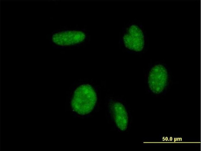 ATOH1 Antibody in Immunocytochemistry (ICC/IF)