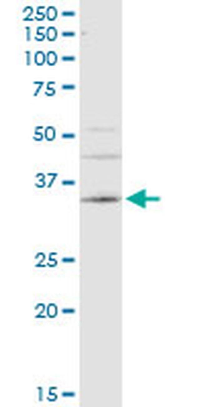 Carbonic Anhydrase IV Antibody in Western Blot (WB)