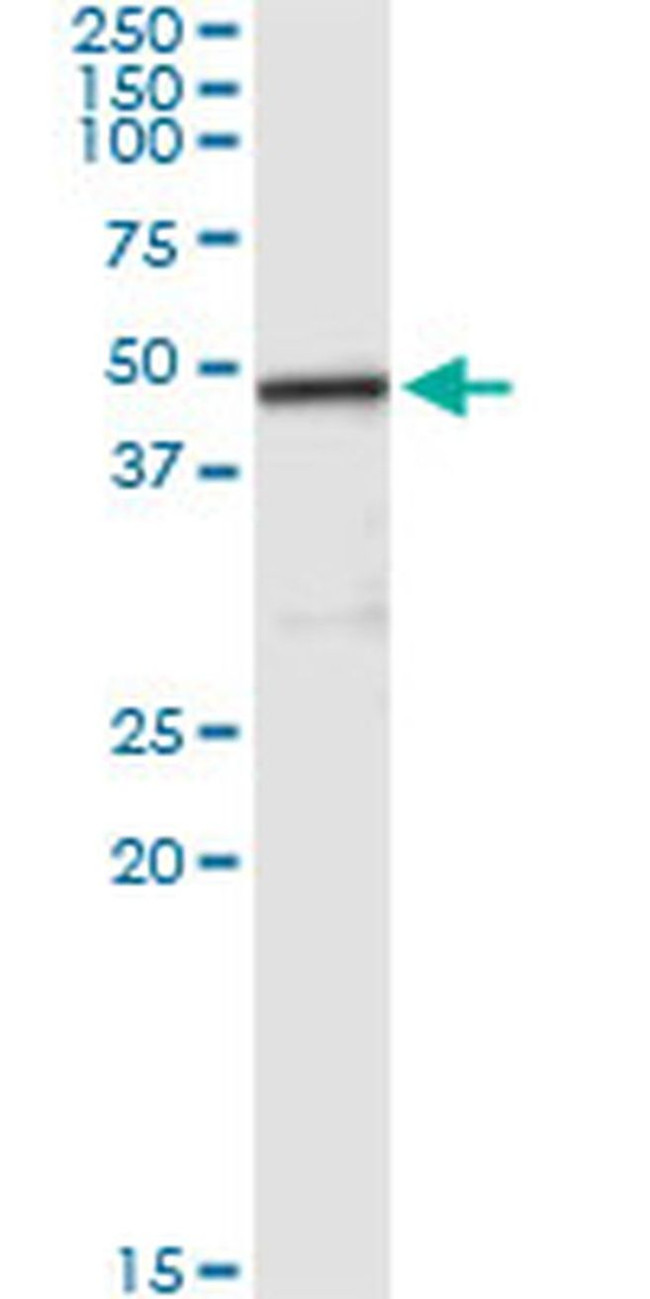 Carboxypeptidase A2 Antibody in Immunoprecipitation (IP)