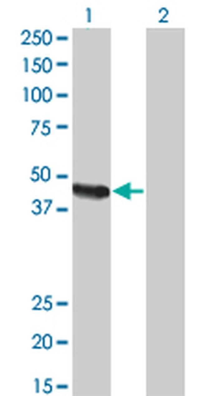 Carboxypeptidase A2 Antibody in Western Blot (WB)