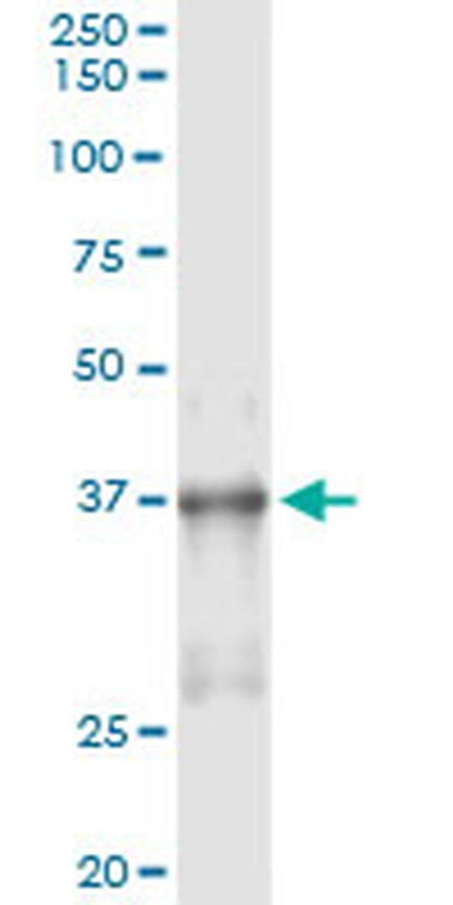 Nkx2.5 Antibody in Immunoprecipitation (IP)