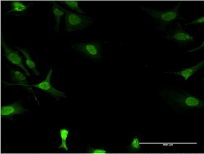 DCK Antibody in Immunocytochemistry (ICC/IF)