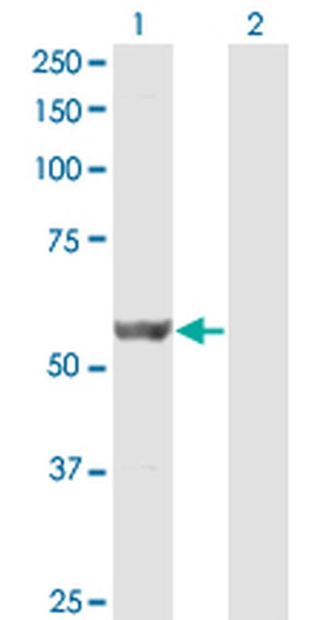 DPH2 Antibody in Western Blot (WB)