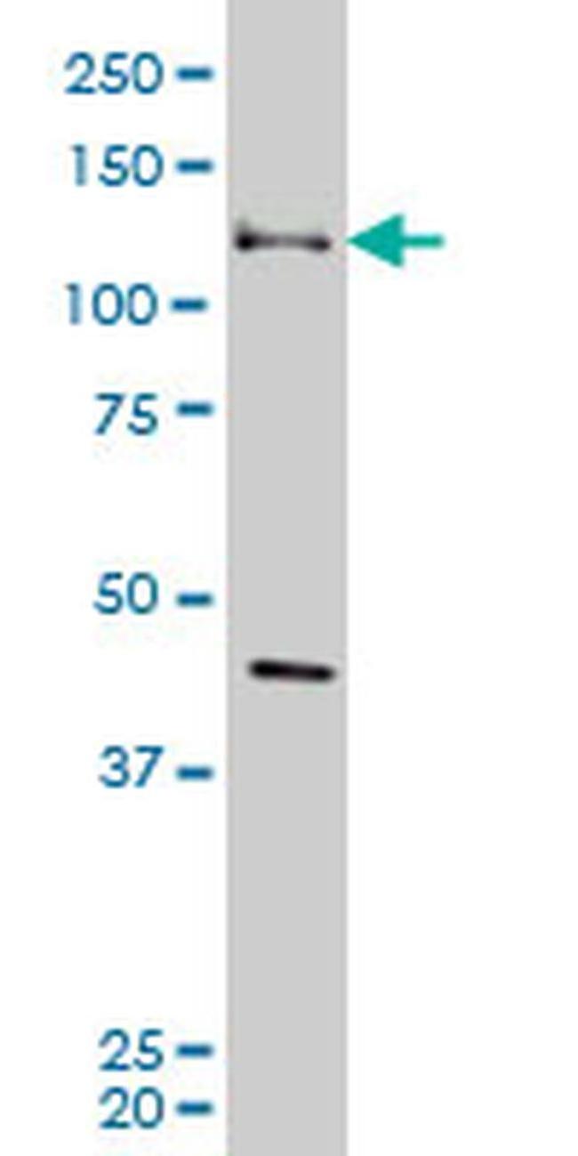 EphB3 Antibody in Western Blot (WB)