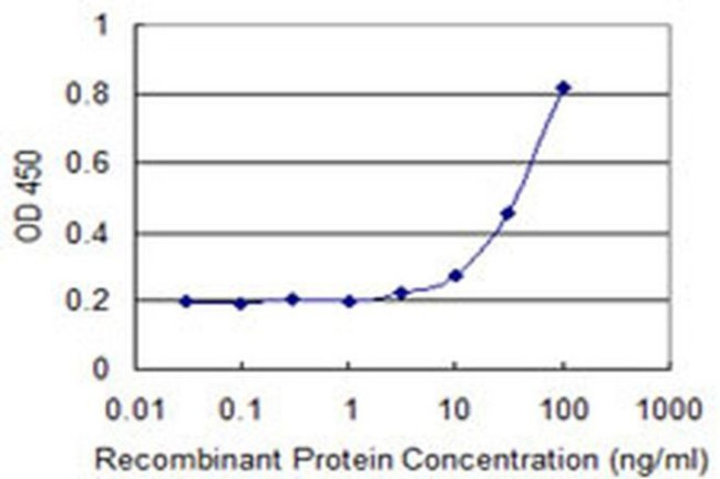 GAMT Antibody in ELISA (ELISA)