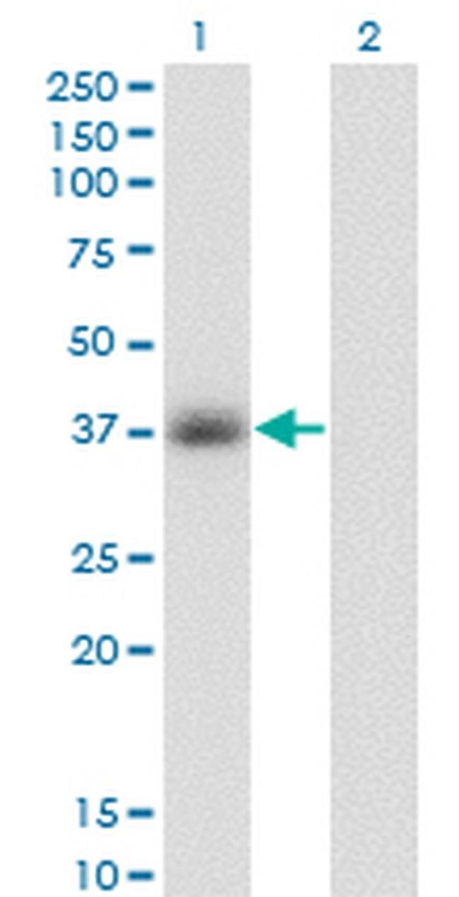 GPD1 Antibody in Western Blot (WB)