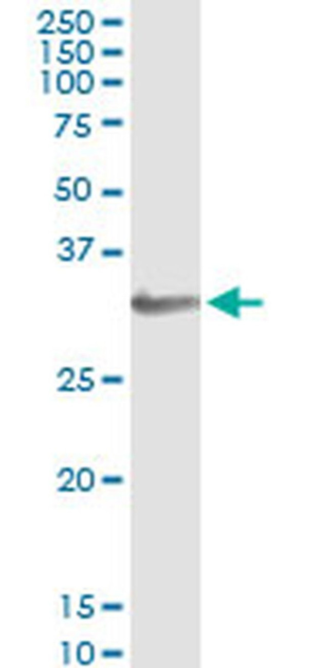 HOXA1/HOXB1/HOXD1 Antibody in Immunoprecipitation (IP)