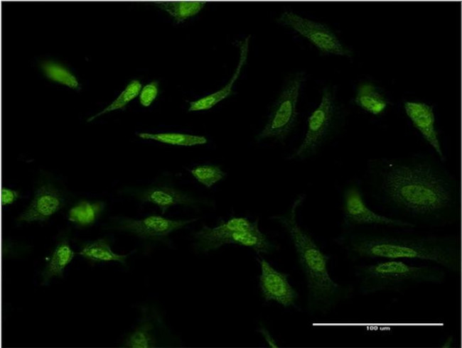 ID1 Antibody in Immunocytochemistry (ICC/IF)