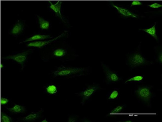 ID1 Antibody in Immunocytochemistry (ICC/IF)