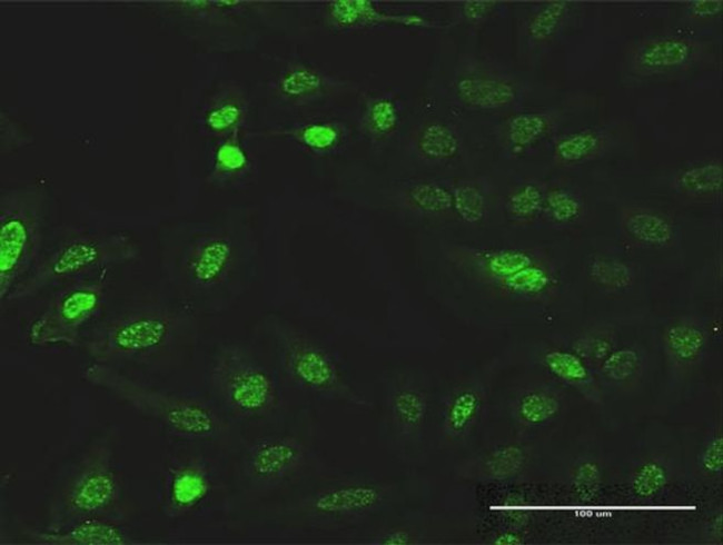 CITED1 Antibody in Immunocytochemistry (ICC/IF)