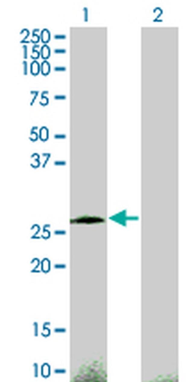 CITED1 Antibody in Western Blot (WB)