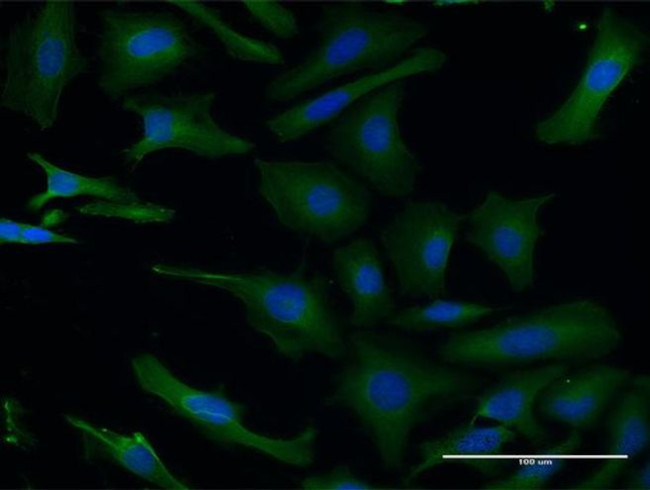 LIS1 Antibody in Immunocytochemistry (ICC/IF)