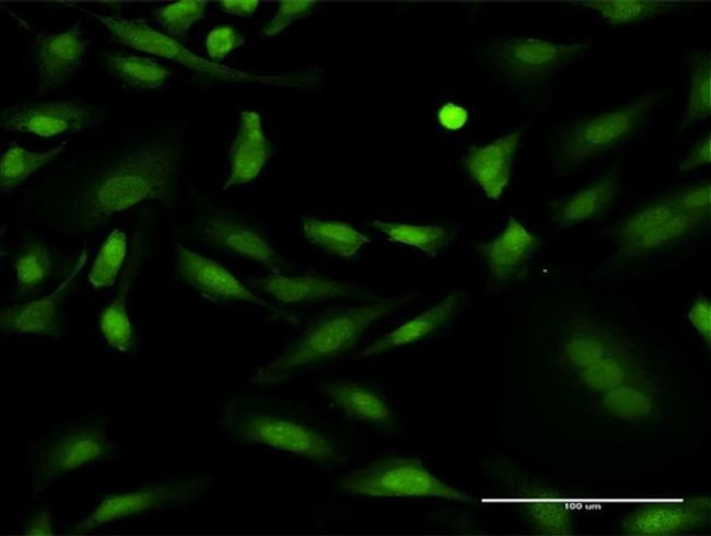 PKC delta Antibody in Immunocytochemistry (ICC/IF)