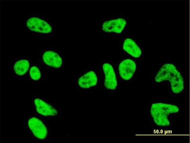 PKN1 Antibody in Immunocytochemistry (ICC/IF)