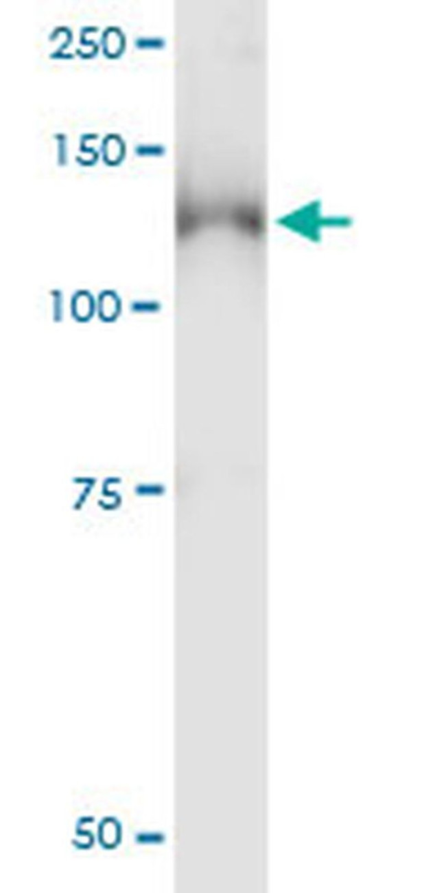 PKN1 Antibody in Immunoprecipitation (IP)