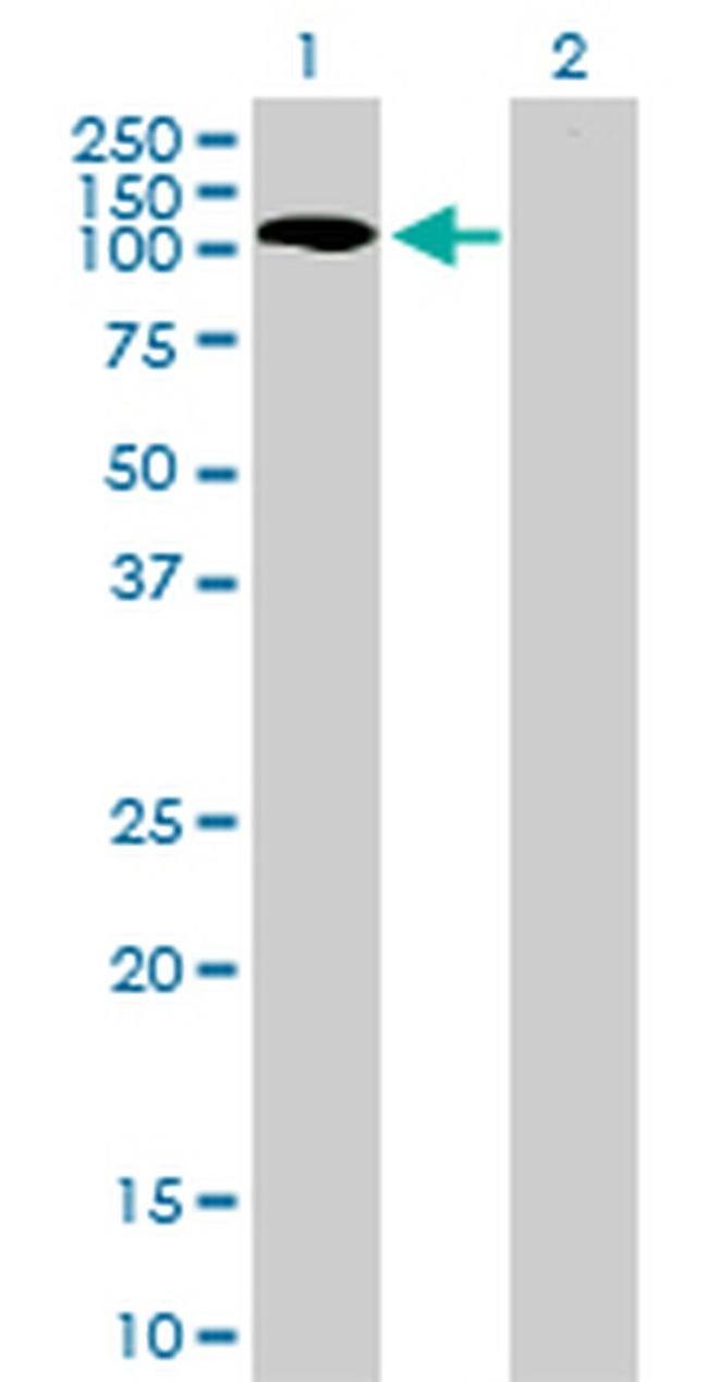 PKN1 Antibody in Western Blot (WB)