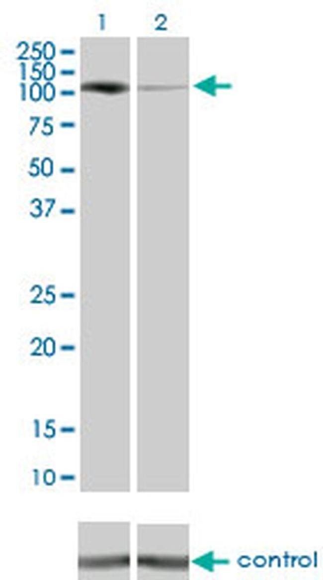 PKN1 Antibody in Western Blot (WB)