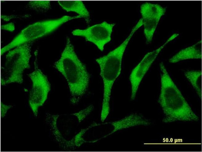 RPL17 Antibody in Immunocytochemistry (ICC/IF)