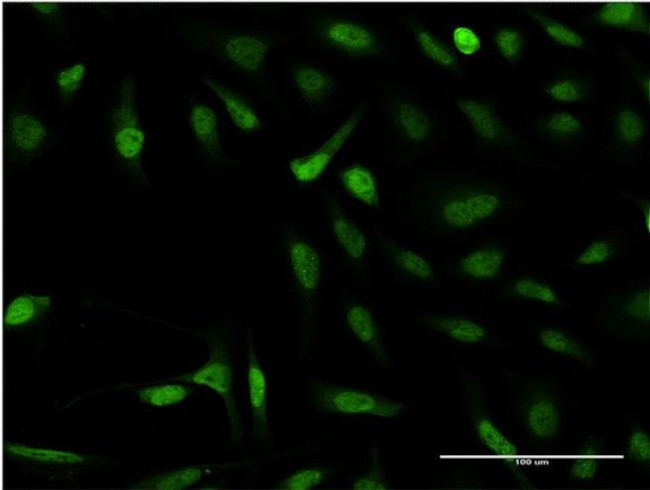 SNAPC4 Antibody in Immunocytochemistry (ICC/IF)