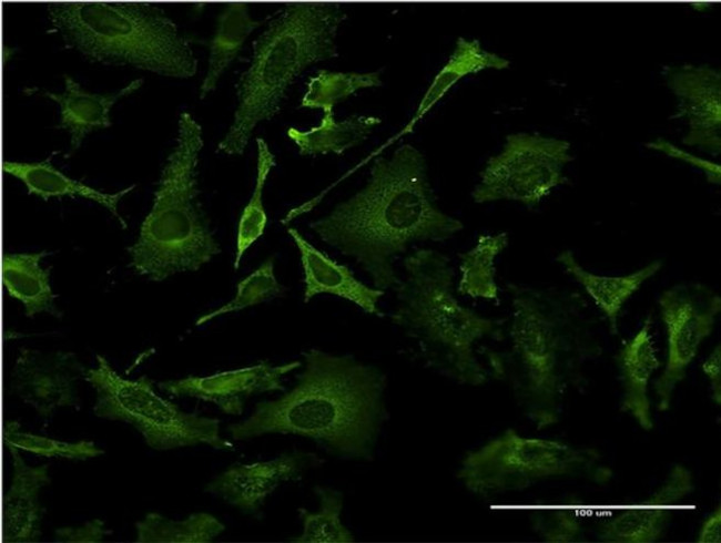 TAP1 Antibody in Immunocytochemistry (ICC/IF)