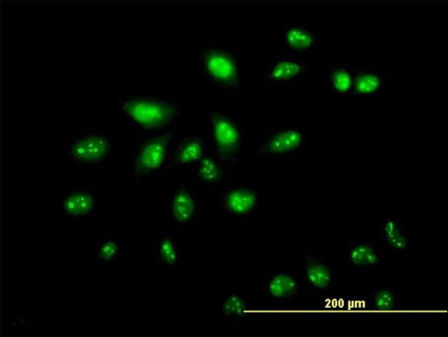 ZNF136 Antibody in Immunocytochemistry (ICC/IF)