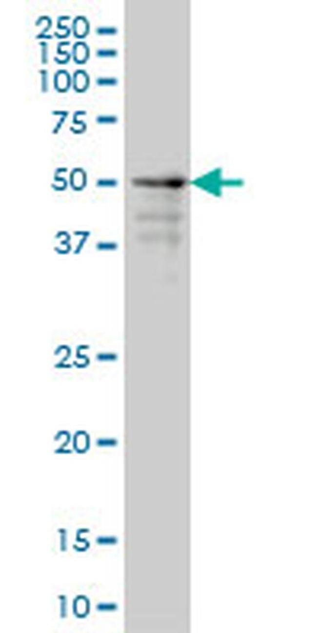 ZNF213 Antibody in Western Blot (WB)