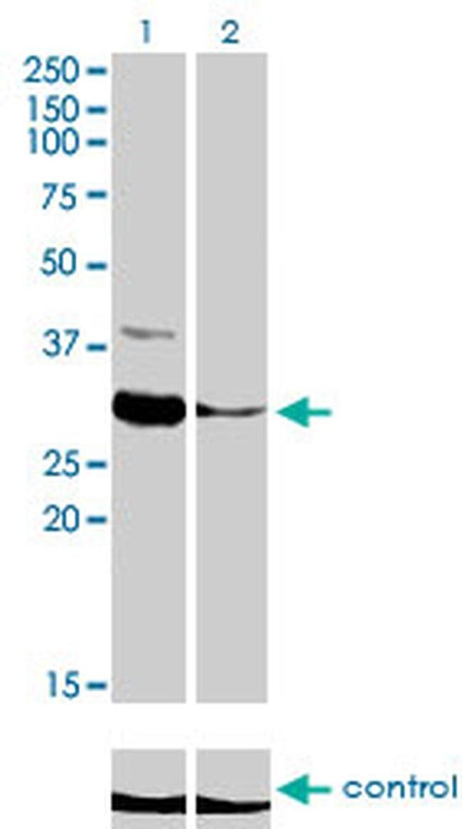 ZNF215 Antibody in Western Blot (WB)