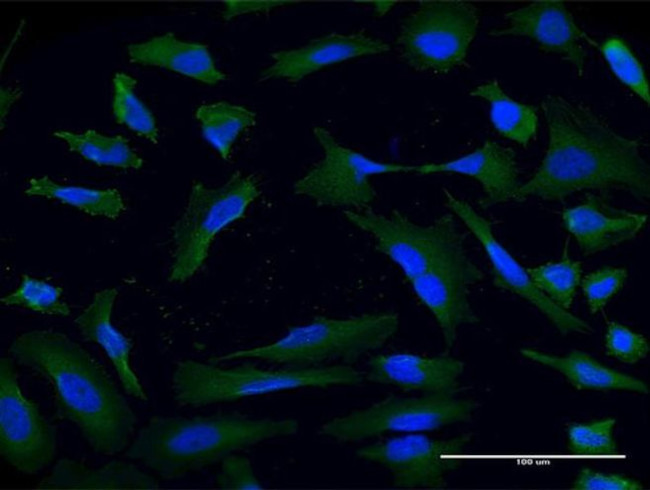 USP9X Antibody in Immunocytochemistry (ICC/IF)