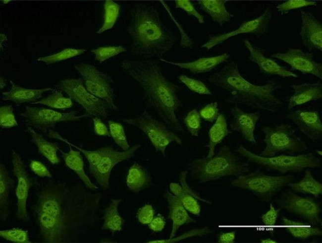 4E-BP3 Antibody in Immunocytochemistry (ICC/IF)