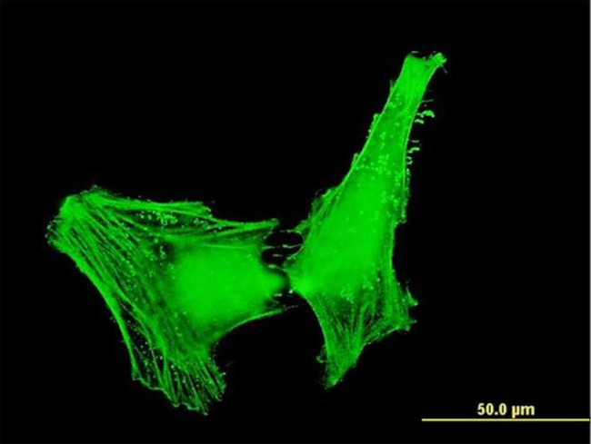 ACTR1B Antibody in Immunocytochemistry (ICC/IF)