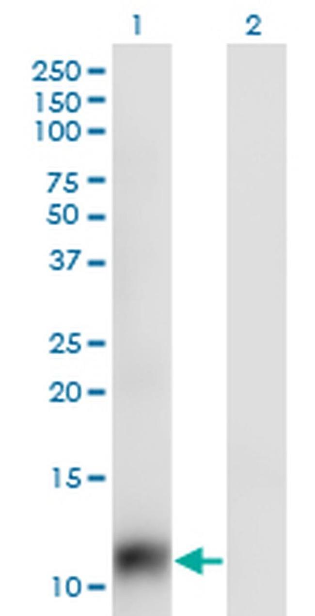 SNAPC5 Antibody in Western Blot (WB)